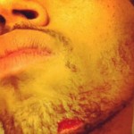 Chris Brown Bleeds After Fight With Drake